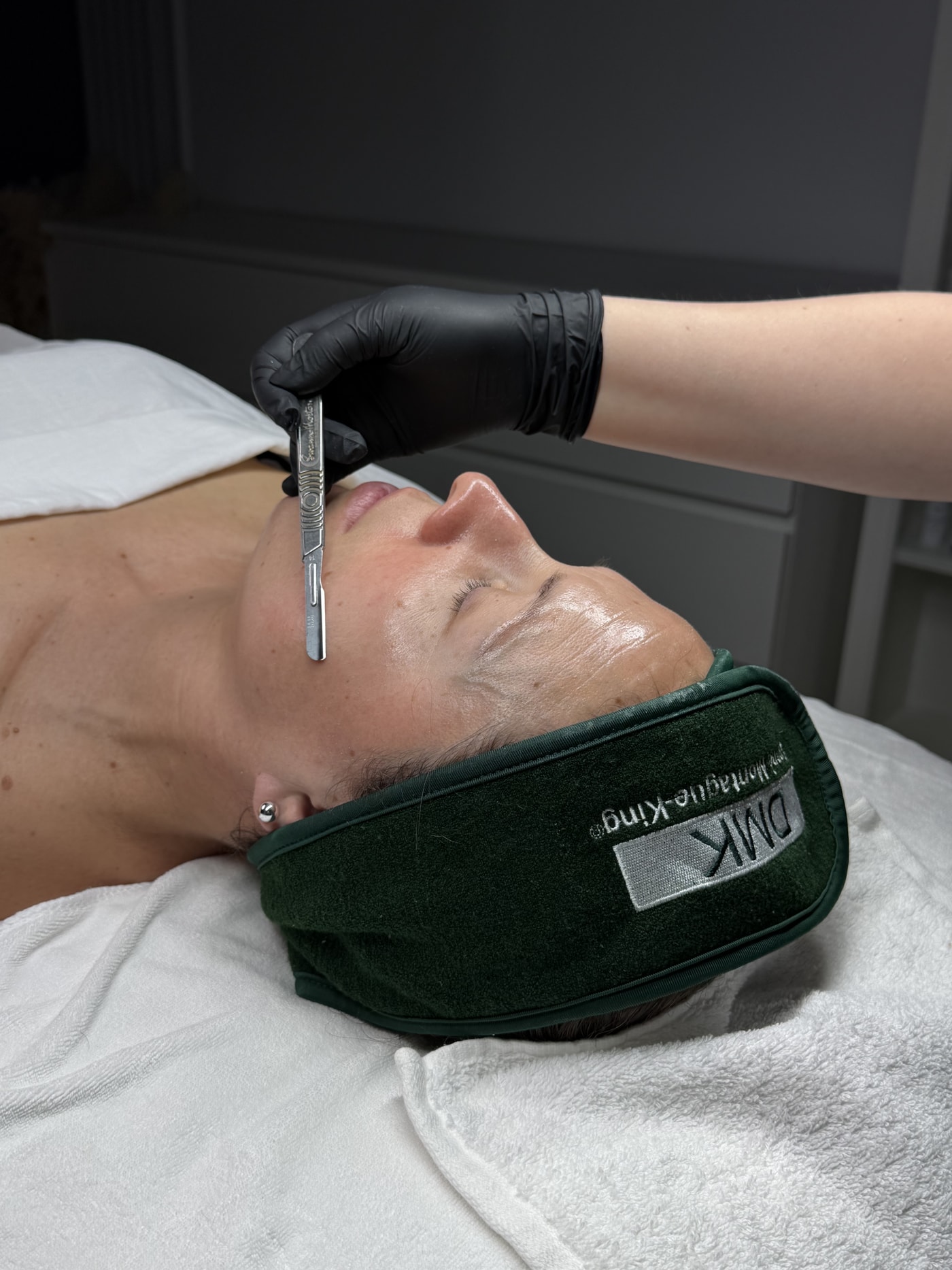 Dermaplaning add-on treatment at SBW Beauty