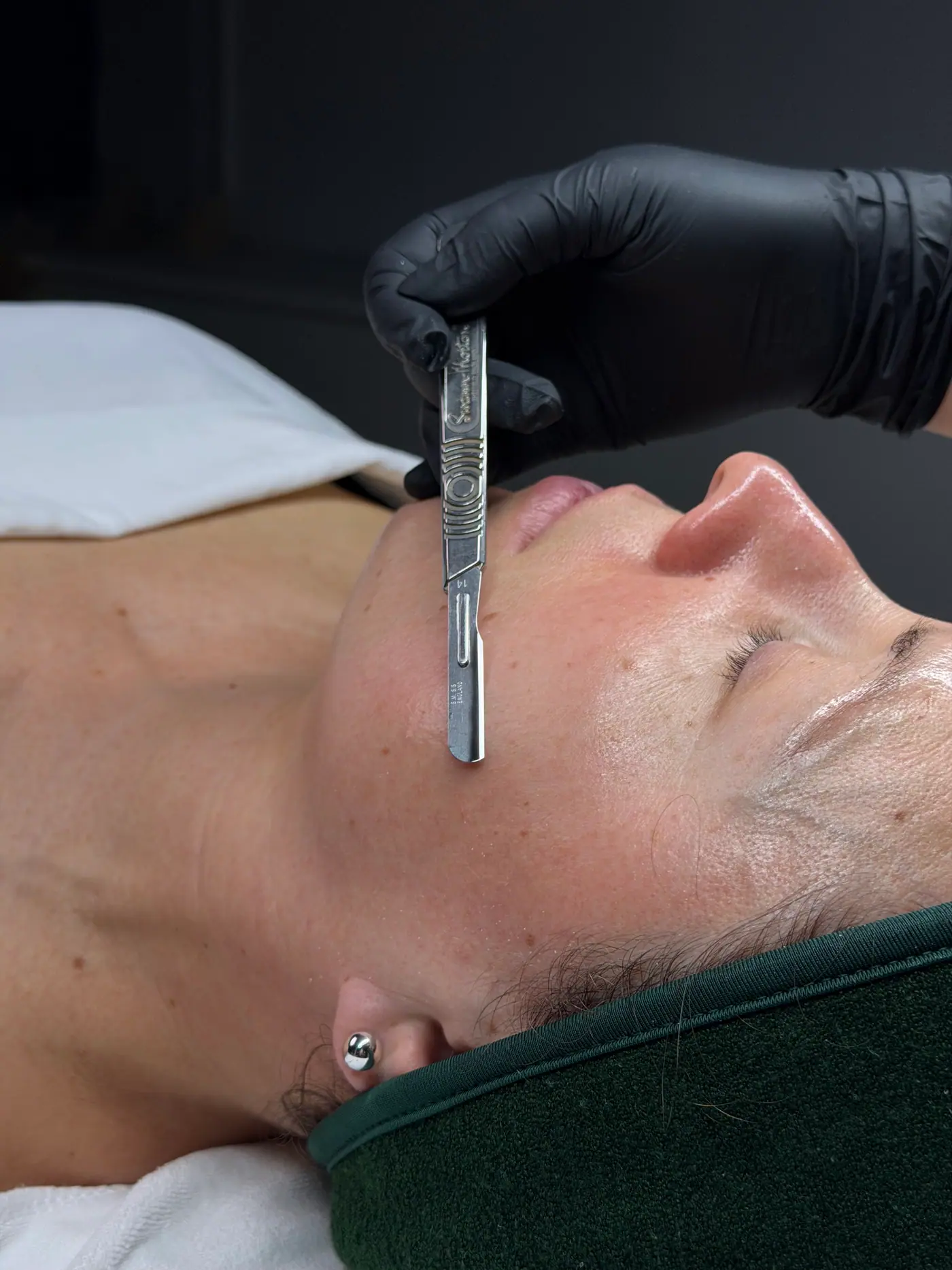 Relaxing dermaplaning facial treatment room in Peabody MA