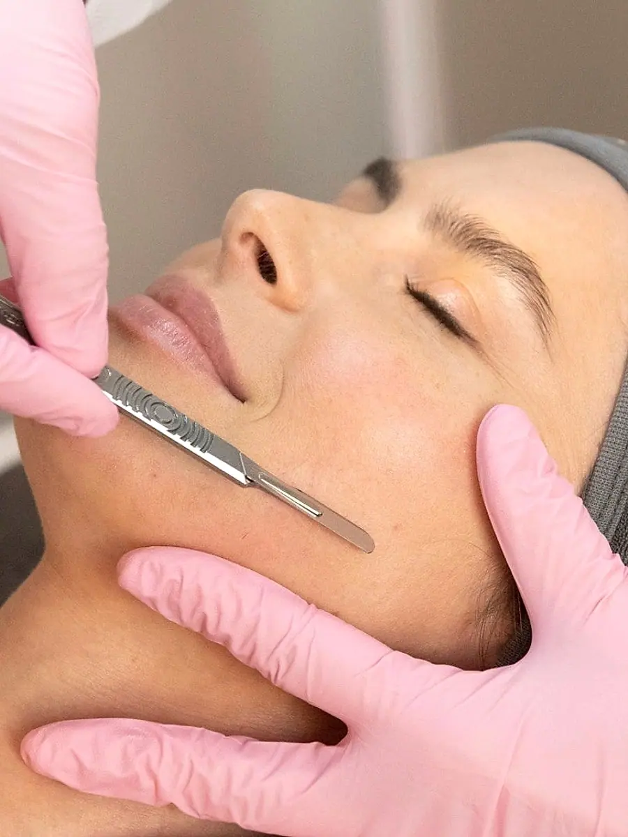 Dermaplaning facial treatment at SBW Beauty in Peabody MA