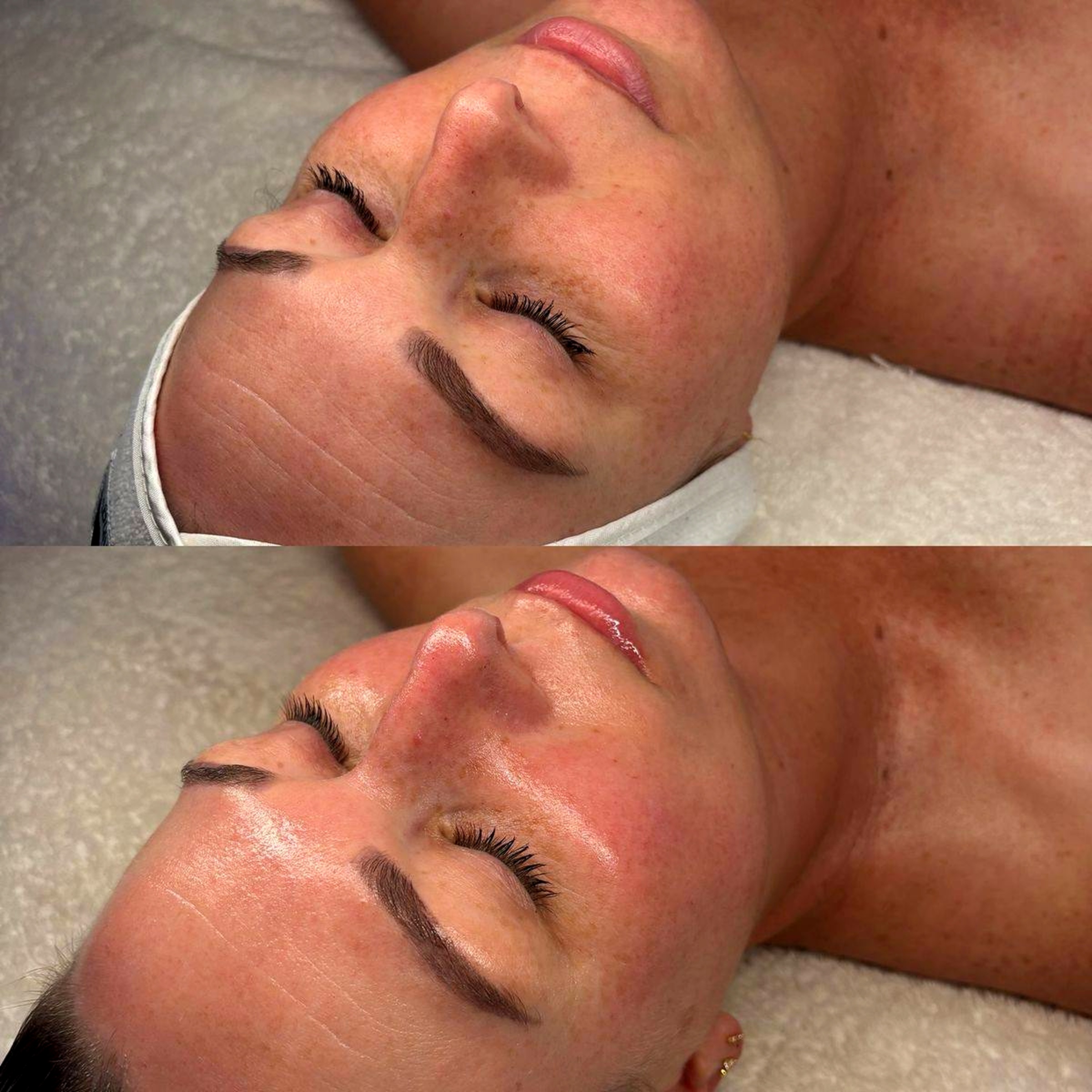 Customized facial before and after result