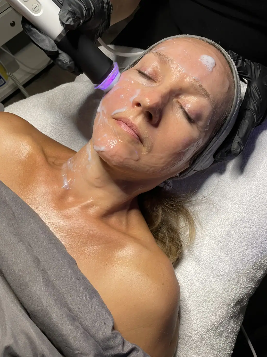 Glow Facial Oxygen Infusion result at SBW Beauty in Peabody MA