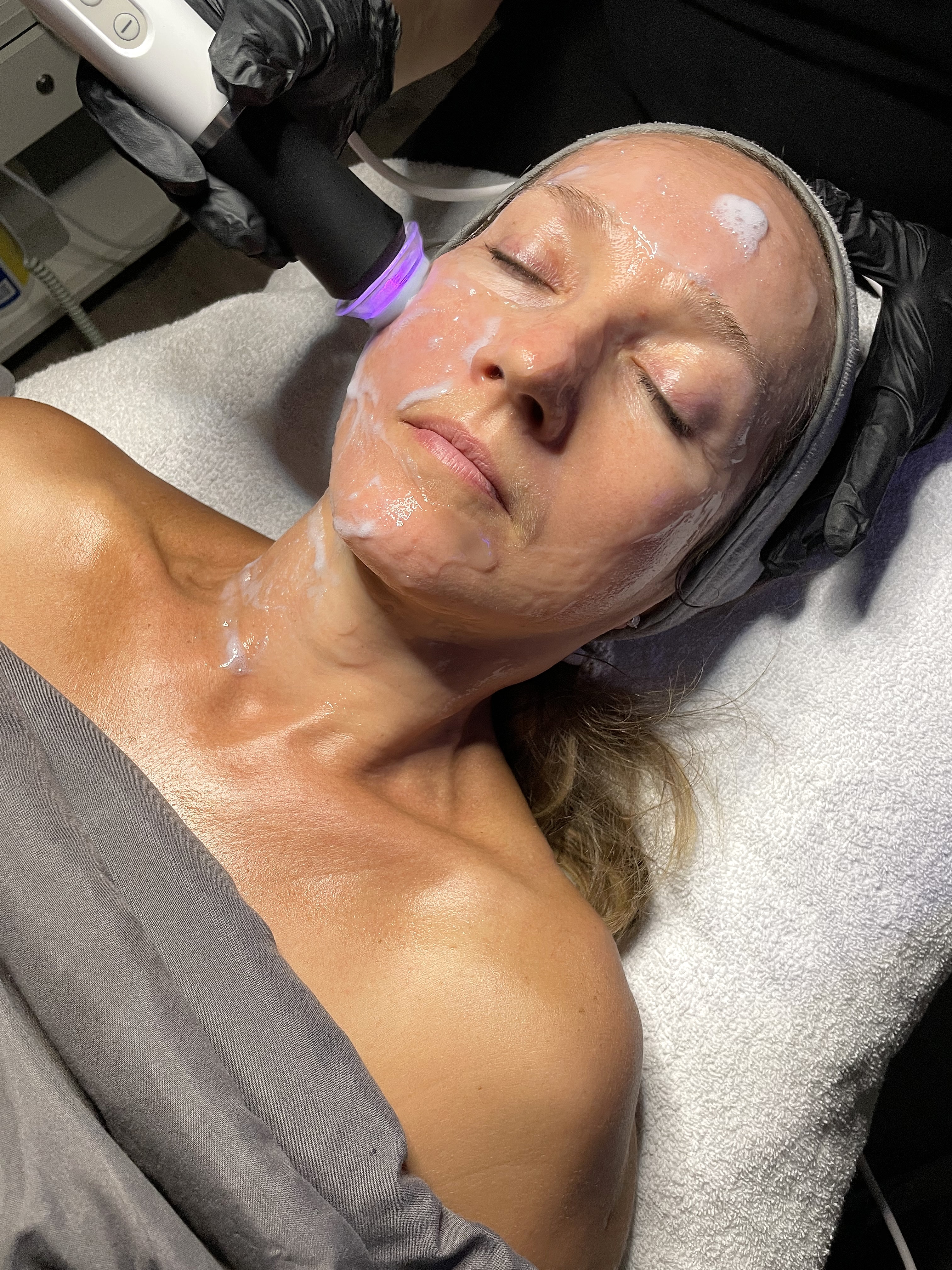 Glow Facial special result at SBW Beauty