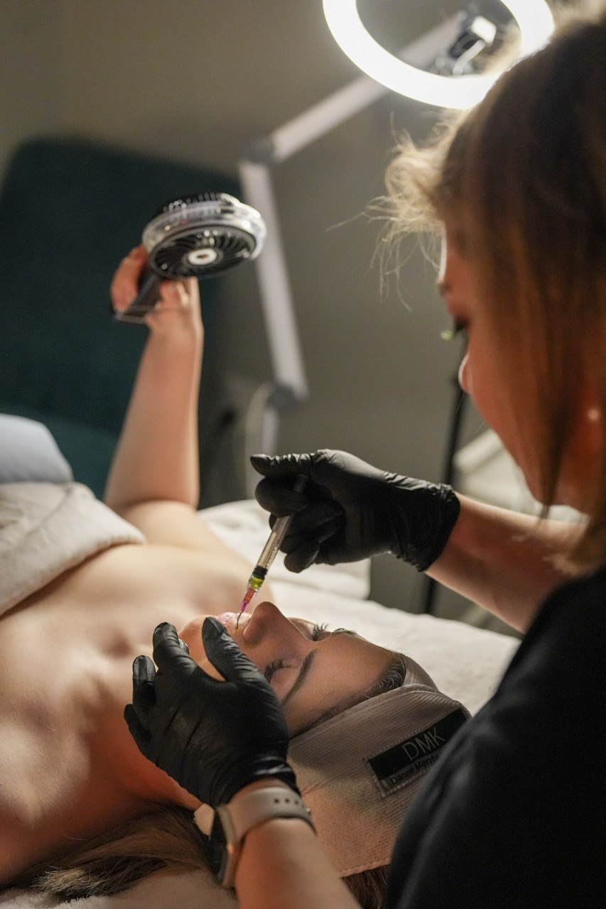 Microneedling with stem cell serum treatment at SBW Beauty